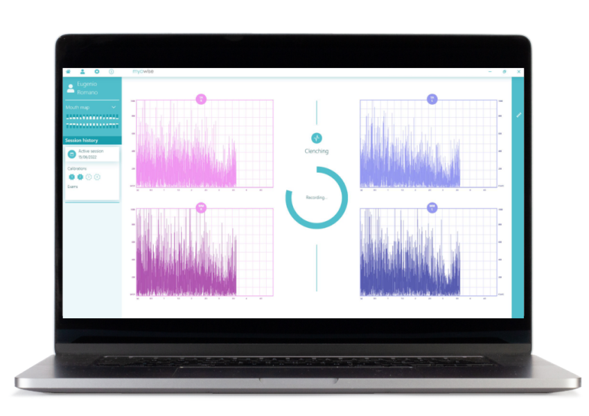 EMG信号のプレビュー