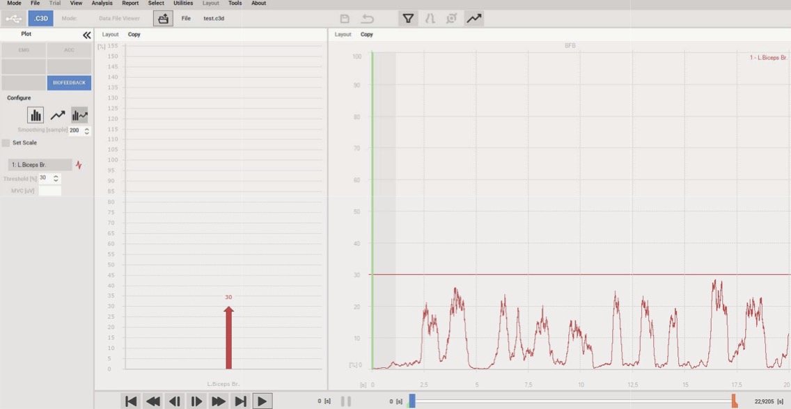 バイオフィールドバック機能